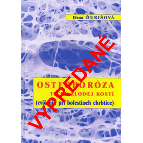 OSTEOPORÓZA tichý zlodej kostí