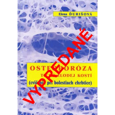 OSTEOPORÓZA tichý zlodej kostí